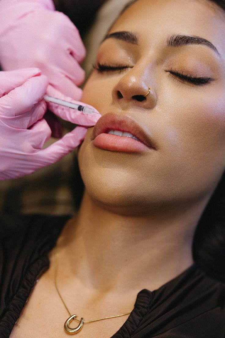 Dermal filler treatment at Avara Medical